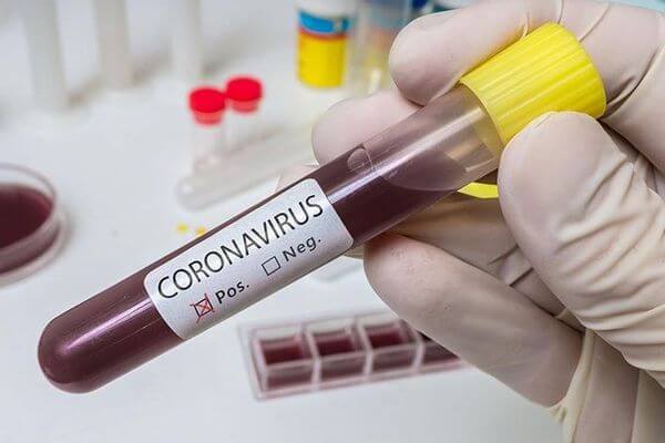 В Самарской области коронавирусом за сутки заболели 110 человек, выздоровели 45 | CityTraffic