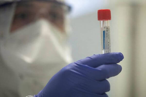 Еще 280 человек заболели коронавирусом в Самарской области | CityTraffic