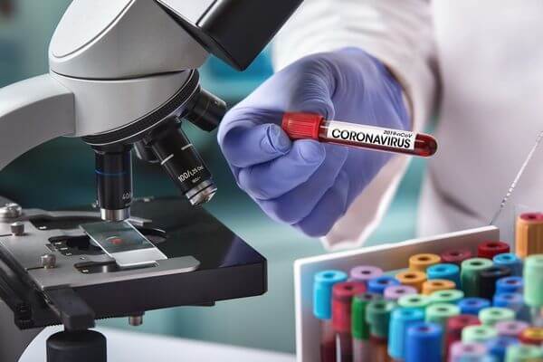 Бессимптомными носителями вируса оказались 17 из 76 новых заболевших COVID-19 в Самарской области