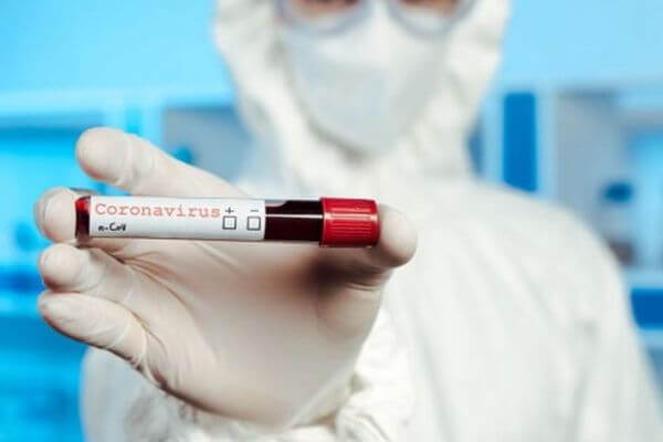 В Самарской области 626 новых заболевших коронавирусом за сутки | CityTraffic