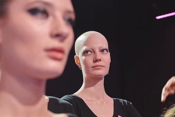 Необычная девушка из Тольятти стала участницей проекта «ТЫ_Топ-модель» на федеральном канале | CityTraffic