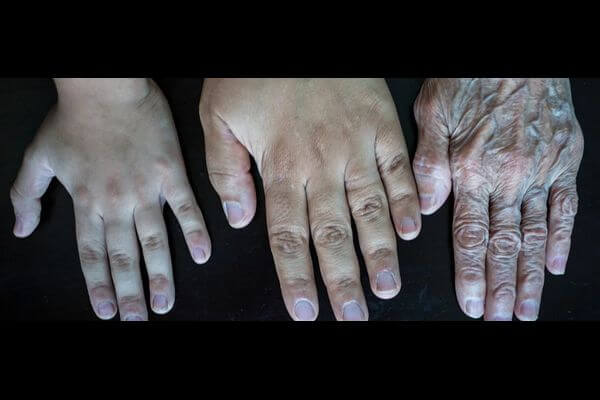 Ученые перепро­грам­ми­ровали клетки кожи человека, омолодив их на 30 лет
